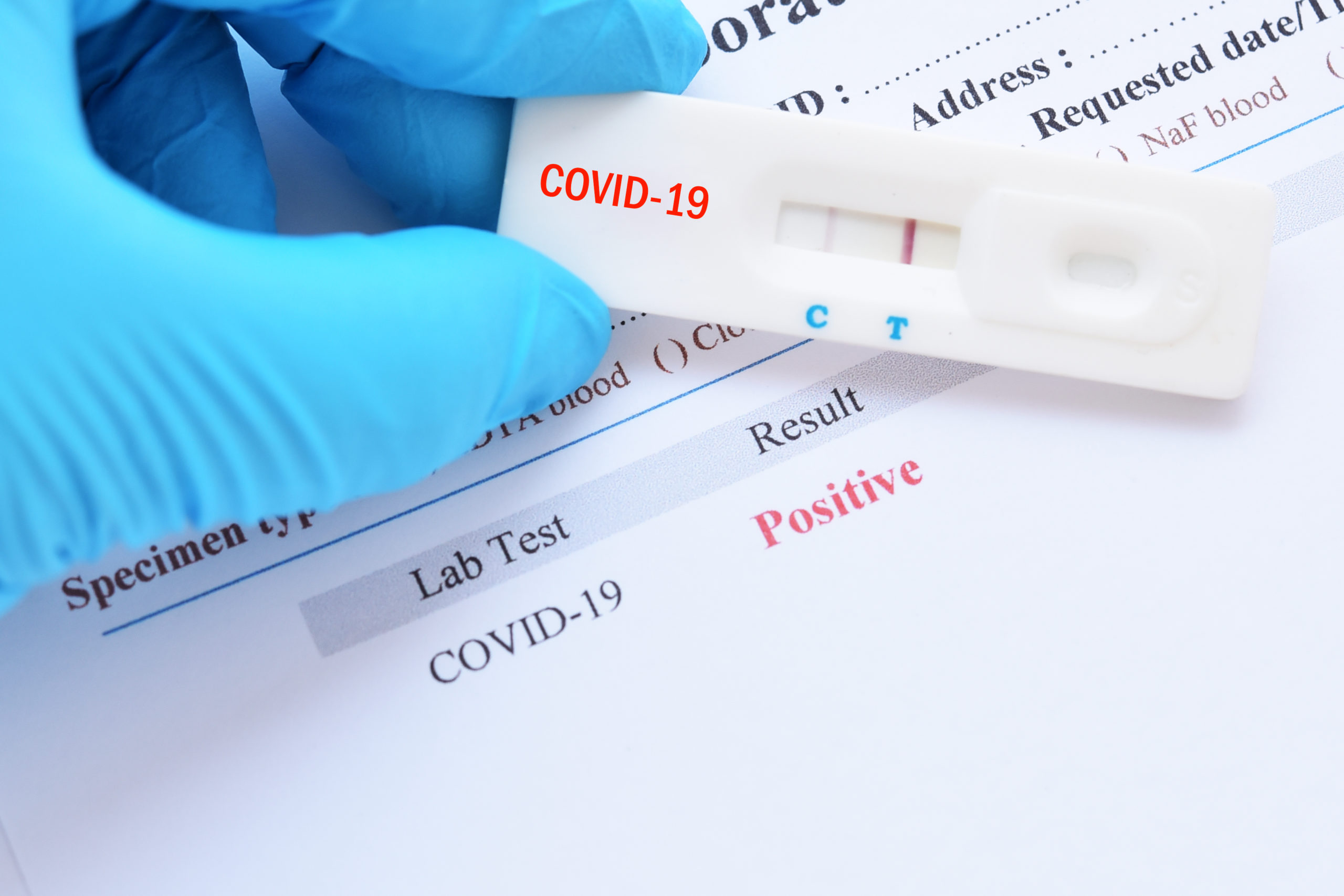 Rapid Pcr Test