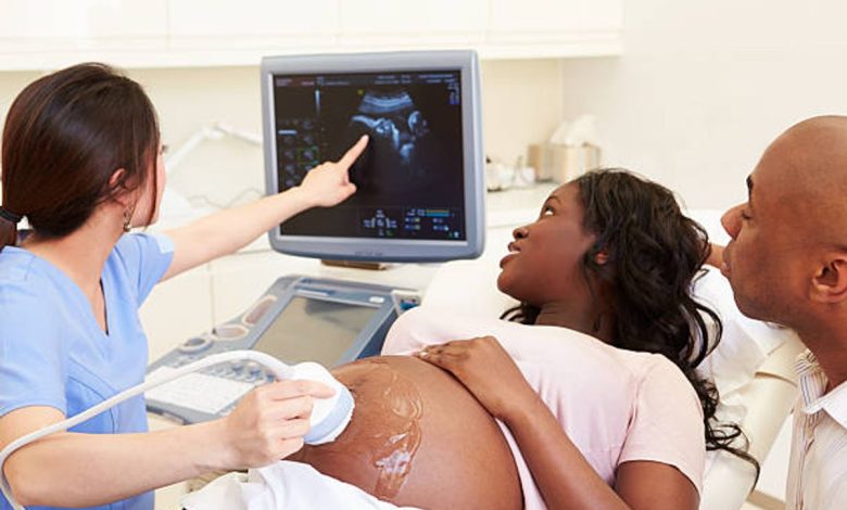 3d sonogram fort worth