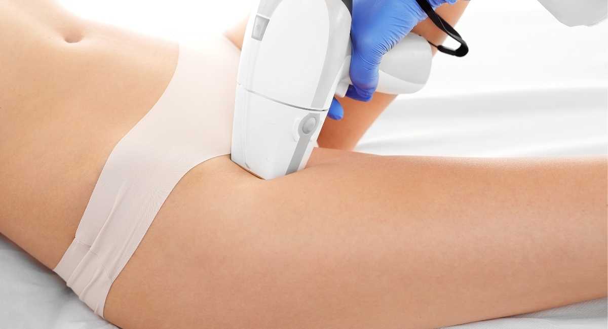 Brazillian Laser Hair Removal